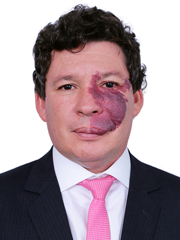 Reginaldo Lázaro De Oliveira Lopes